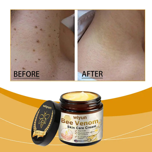 MyClinic™ Bee Venom Cream | Repairs your skin in 24 hours! Original